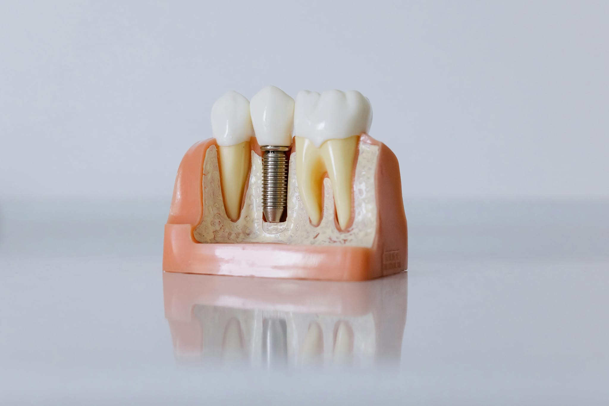 Emergency Dental Care